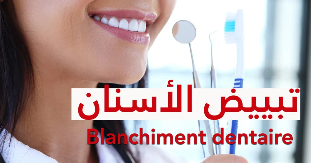 تبييض الأسنان